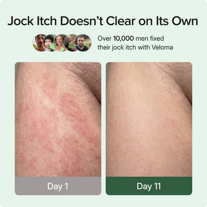 Antifungal Soap